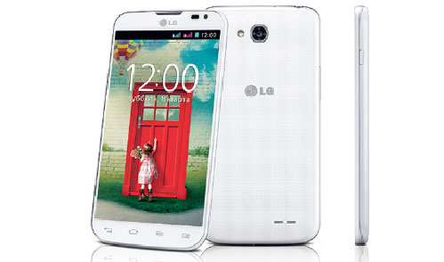 L70 Dual có hai màu đen trắng Bộ đôi smartphone 2 sim tầm trung của LG về Việt Nam