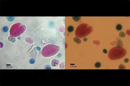 Ảnh chụp bằng Micro Lens bản thử nghiệm bên trái và ảnh phải chụp bằng máy ảnh giá 499 USD và một kính hiển vi giá 2.224 USD Kính hiển vi phóng đại 150 lần cho smartphone