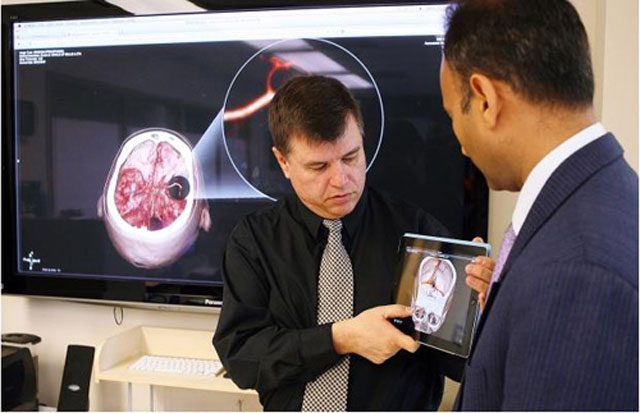 Dùng iPad chẩn đoán đột quỵ