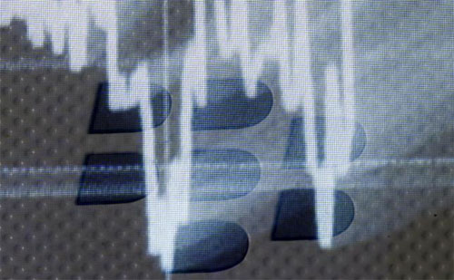 BlackBerry bắt đầu sa thải nhân viên trên toàn cầu BlackBerry bắt đầu sa thải nhân viên trên toàn cầu