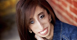 21 câu nói truyền cảm hứng từ “cô gái xấu xí nhất thế giới” Lizzie Velasquez và bằng chứng cho một vẻ đẹp chân chính