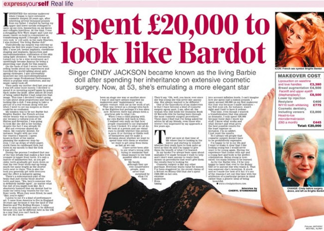 Người phẫu thuật thẩm mỹ nhiều nhất từ trước tới nay.