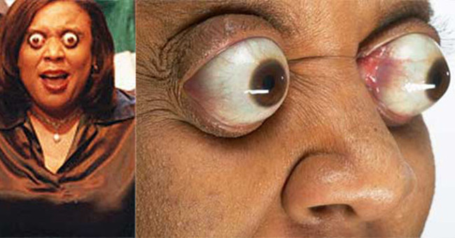 Chắc chắn ai cũng phải kinh ngạc khi chứng kiến Kim Goodman điều khiển nhãn cầu mắt của mình. Cô đã lập kỷ lục thế giới là người có nhãn cầu lồi nhất thế giới khi điều khiển nhãn cầu lồi rà 1,2 cm tính từ hốc mắt.