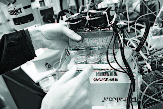 Loại máy thay thế máu bằng dung dịch nước muối lạnh.  Loại máy thay thế máu bằng dung dịch nước muối lạnh.