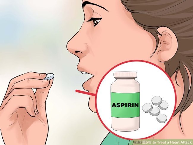 Uống một viên aspirin hay nitroglycerin theo sự chỉ dẫn của bác sĩ Uống một viên aspirin hay nitroglycerin theo sự chỉ dẫn của bác sĩ