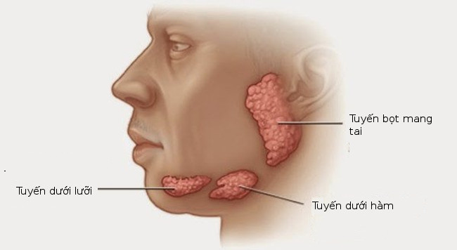 Tuyến nước bọt 