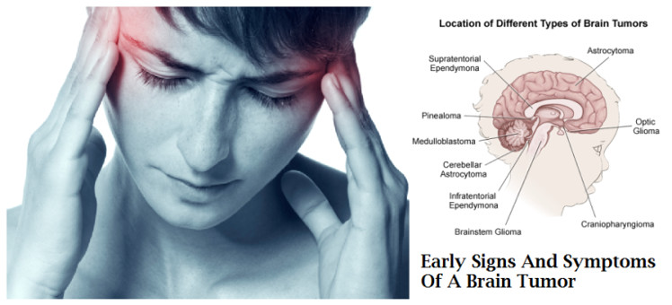 Rối loạn tâm thần 