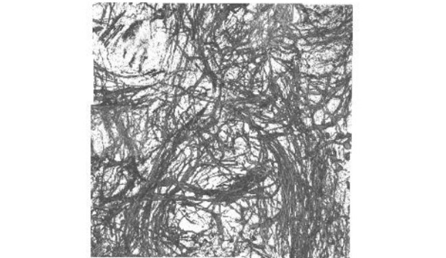 Mạng Neuron của loài ruồi giấm được chụp ở độ phân giải 140 nanomet