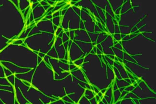 Hình ảnh vi khuẩn methanogen qua kính hiển vi điện tử.