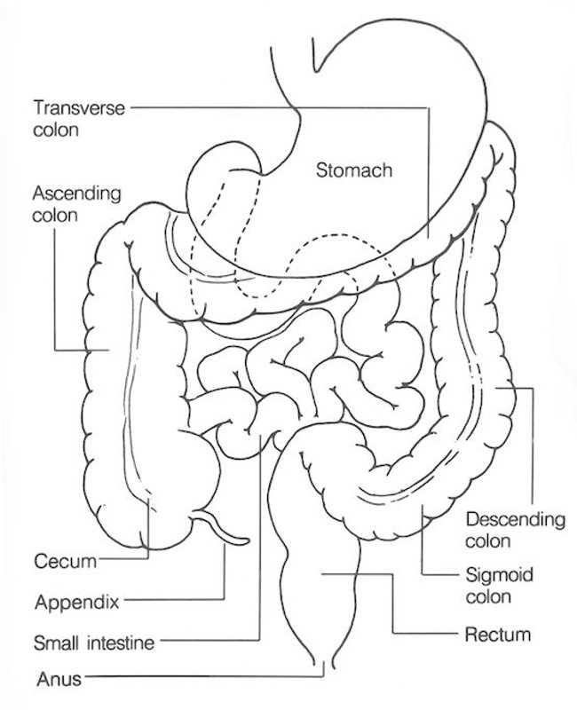 Ung thư kết trực tràng