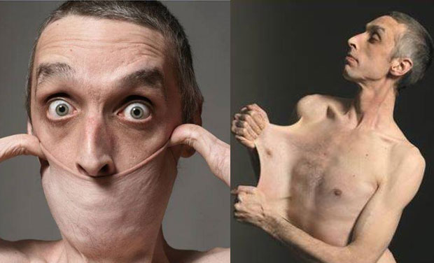 Làn da co giãn Làn da co giãn