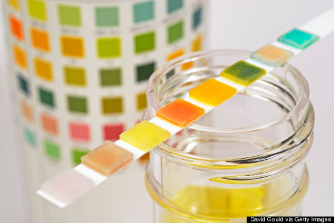 Xét nghiệm nước tiểu 