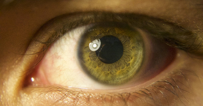 Quét lâm sàng võng mạc mắt 