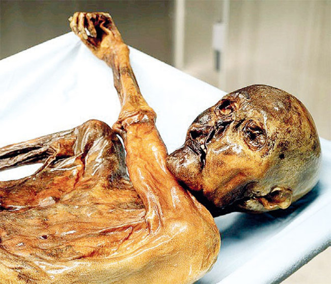 Iceman Otzi