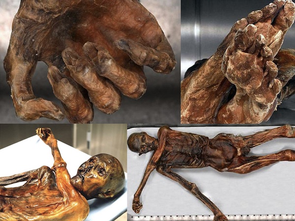 Người băng Otzi