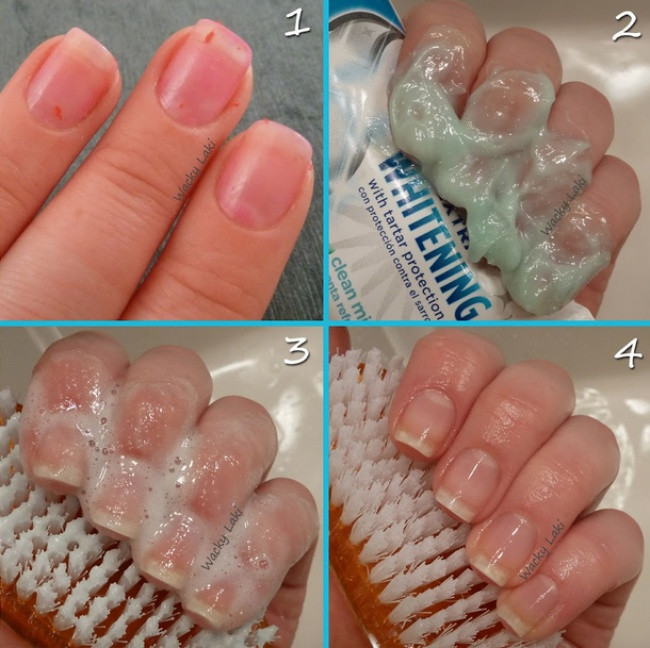 Tẩy sơn móng tay 