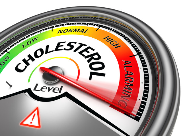 Cholesterol tăng cao có thể khiến viêm khớp nặng hơn