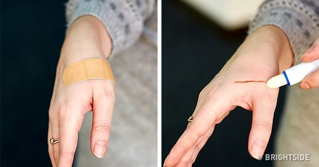 Làm dịu các vết đứt tay nhỏ hoặc vết côn trùng cắn Làm dịu các vết đứt tay nhỏ hoặc vết côn trùng cắn