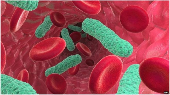 Nếu kháng sinh mất tác dụng, những người nhiễm trùng máu sẽ khó có cơ hội sống sót.