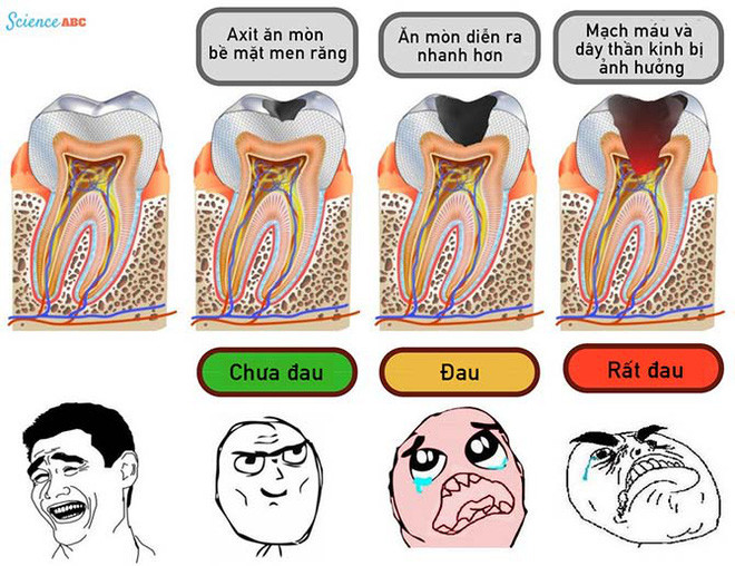 Bệnh sâu răng 