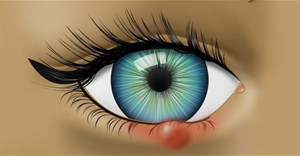 8 dấu hiệu bất thường ở mắt cảnh báo về sức khỏe của bạn