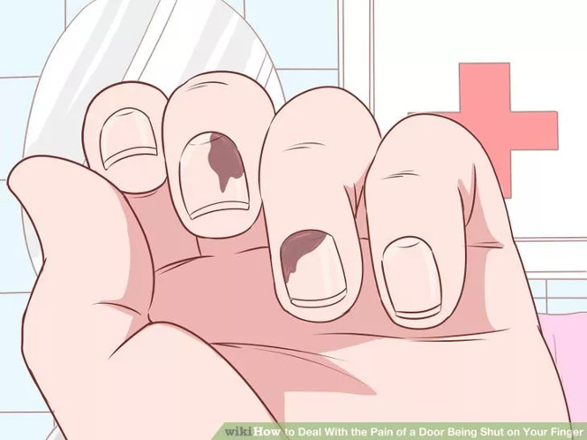 Bảo đảm lòng móng tay không bị chấn thương