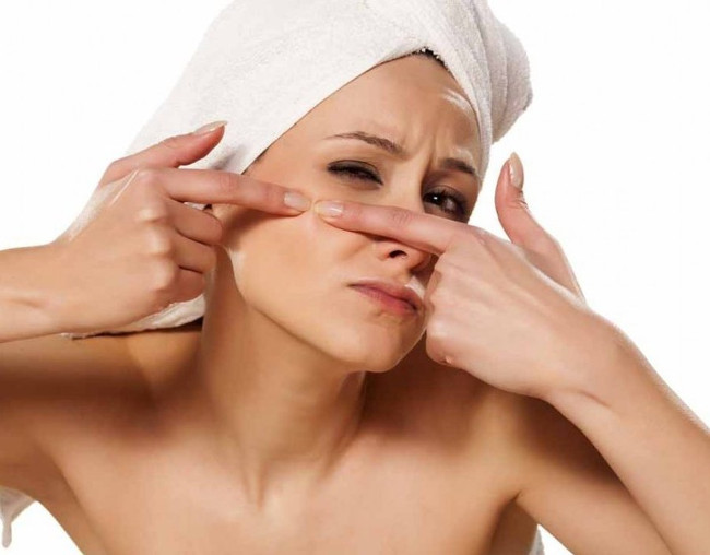 Mụn trứng cá giảm đi rõ rệt