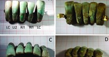 Khảo cổ Ý tìm ra bộ răng giả lâu đời nhất trên thế giới