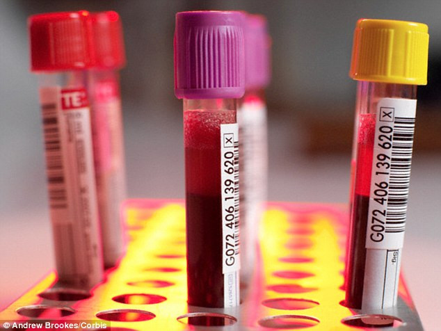 Xét nghiệm máu có thể tìm ra các bệnh 