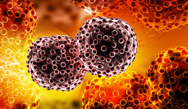 Nguyên nhân bệnh ung thư có thể là do bênh trầm cảm 