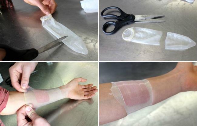 Chống ướt cho băng gạc bằng bao cao su   Chống ướt cho băng gạc bằng bao cao su