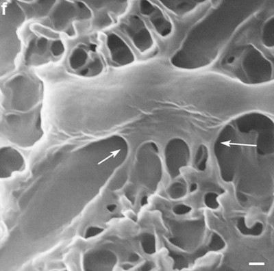 Những "ngón tay" của vi khuẩn bám vào bề mặt bàn đinh