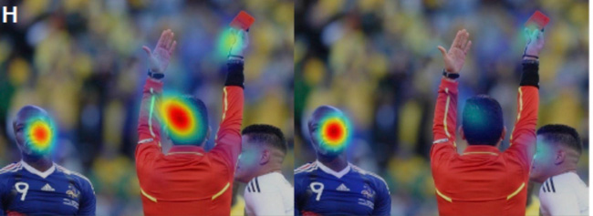 Trẻ em bị tự kỷ thường thích nhìn gương mặt trông méo mó hơn là những gương mặt bình thường