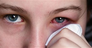 Cách phòng và điều trị bệnh đau mắt đỏ