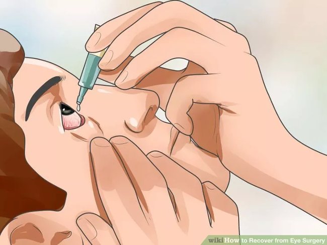 Tra thuốc nhỏ mắt