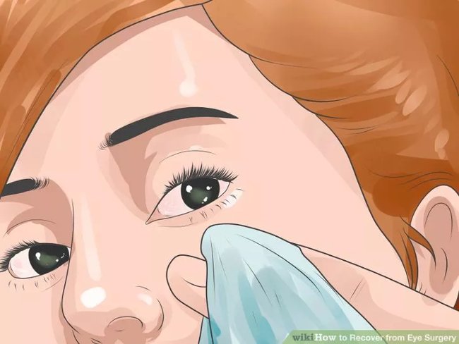 Rửa mắt theo hướng dẫn của bác sĩ