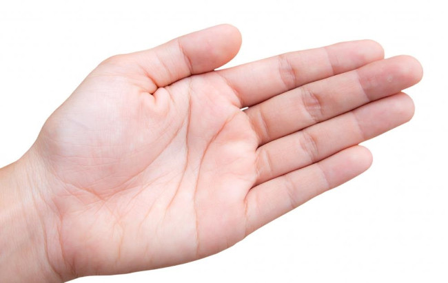 Da dày ở lòng bàn chân hoặc tay là dấu hiệu bệnh ung thư Da dày ở lòng bàn chân hoặc tay là dấu hiệu bệnh ung thư