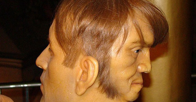 Edward Mordrake với hai khuôn mặt trên đầu 