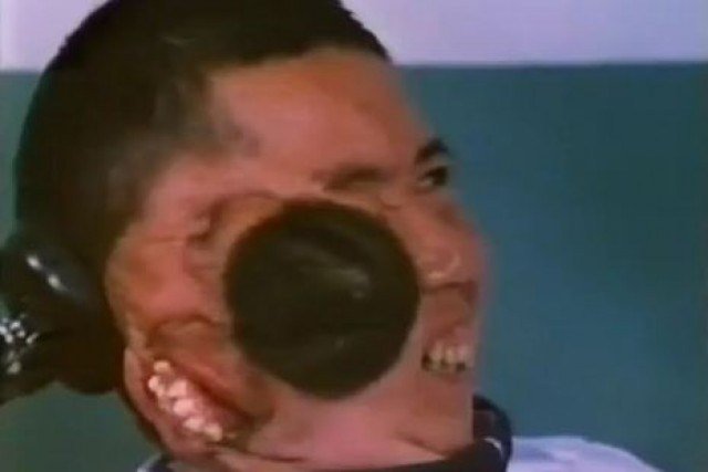 Trương Tử Bình với khuôn mặt phụ ở góc phải của đầu 