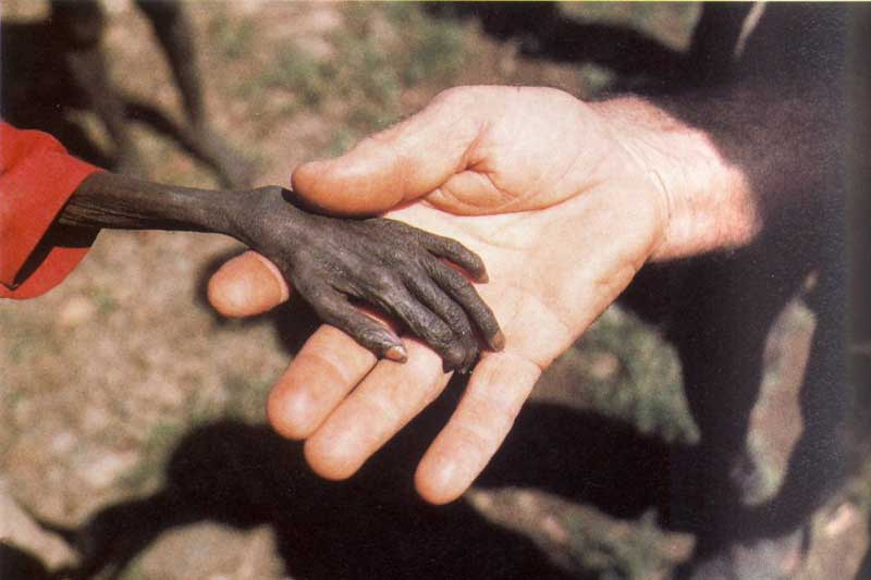 Cánh tay cậu bé chết đói đặt trên bàn tay của một nhà truyền giáo Uganda Cánh tay cậu bé chết đói đặt trên bàn tay của một nhà truyền giáo Uganda