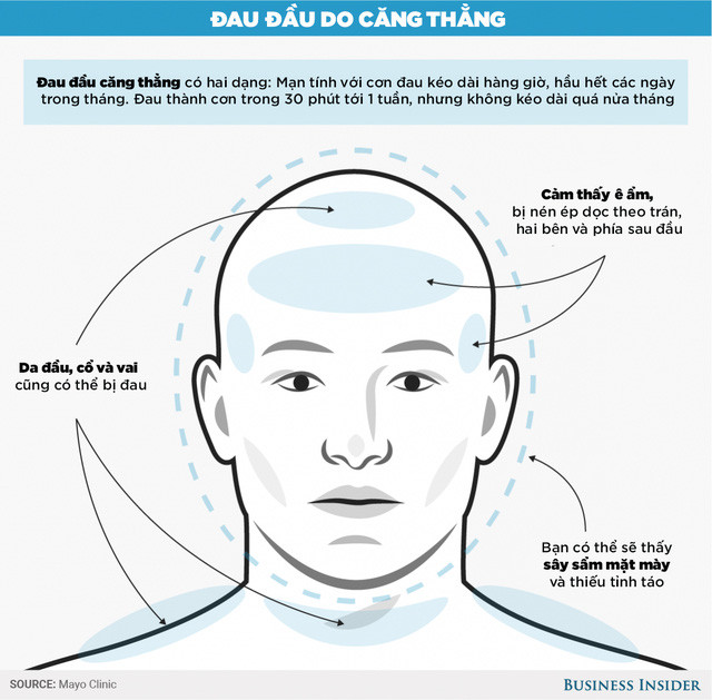 Đau đầu do căng thẳng