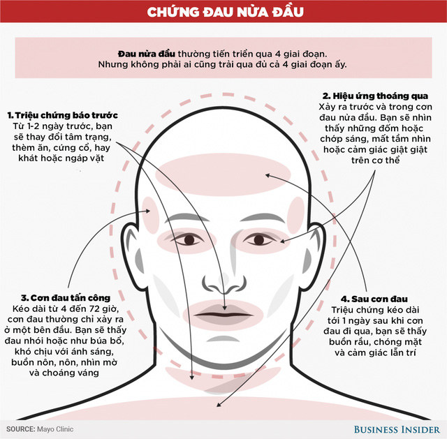 Bệnh đau nửa đầu