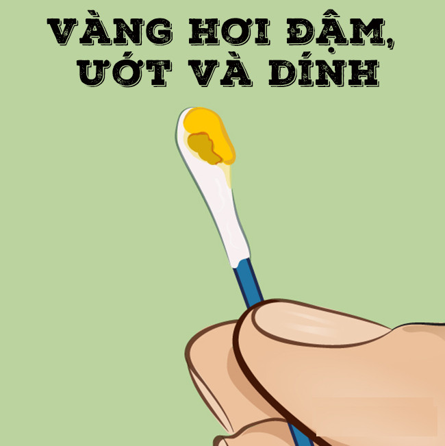 Ráy tai có màu vàng đậm, hơi ướt và dính