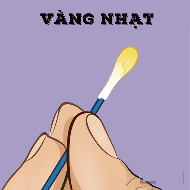 Ráy tay có màu vàng nhạt