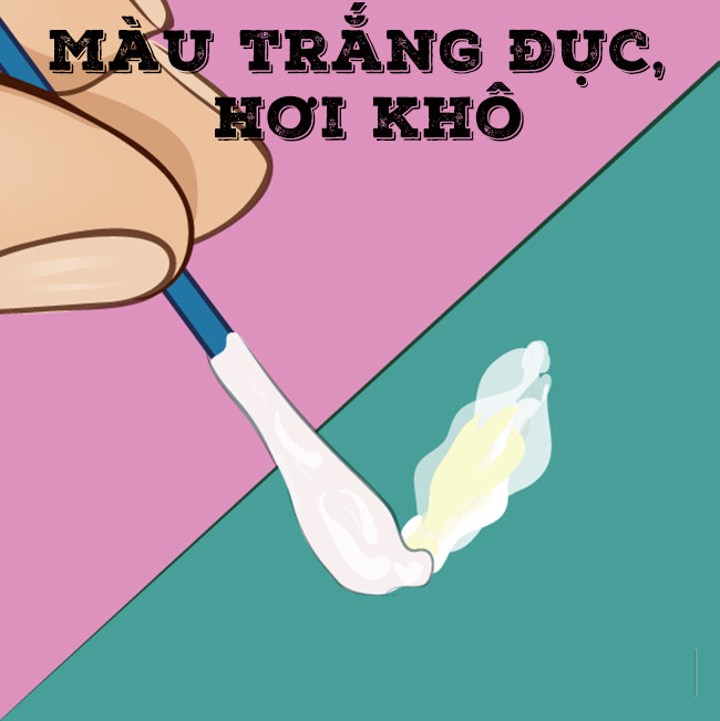 Ráy tai khô, trắng đục