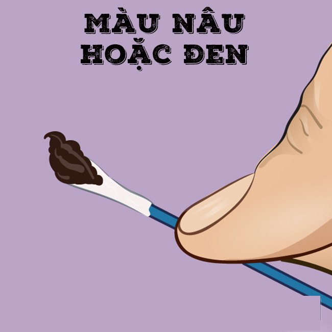 Ráy tai có màu nâu, đen