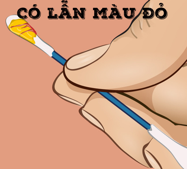 Ráy tai có lẫn máu khô