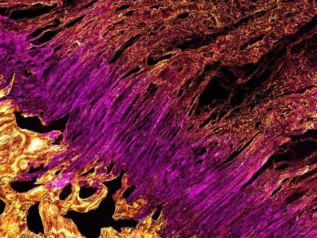 Việc kết nối các sợi gân ở bàn chân con người Việc kết nối các sợi gân ở bàn chân con người