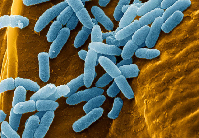 Trực khuẩn mủ xanh Trực khuẩn mủ xanh