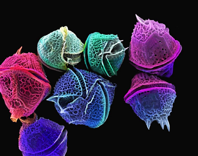 Sinh vật biển phù du có tên tảo đơn bào hai roi (Dinoflagellates)